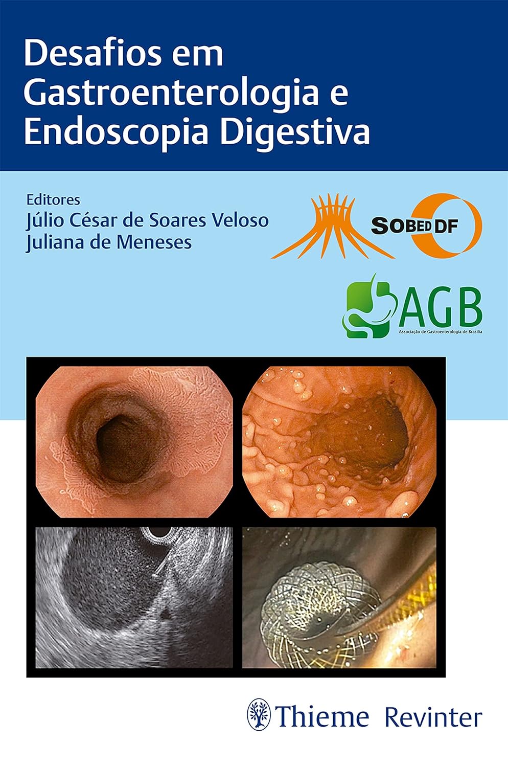 Desafios em Gastroenterologia e Endoscopia Digestiva (Portuguese Edition) 