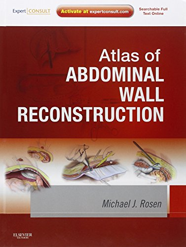 Atlas of Abdominal Wall Reconstruction - Ebook345-Store