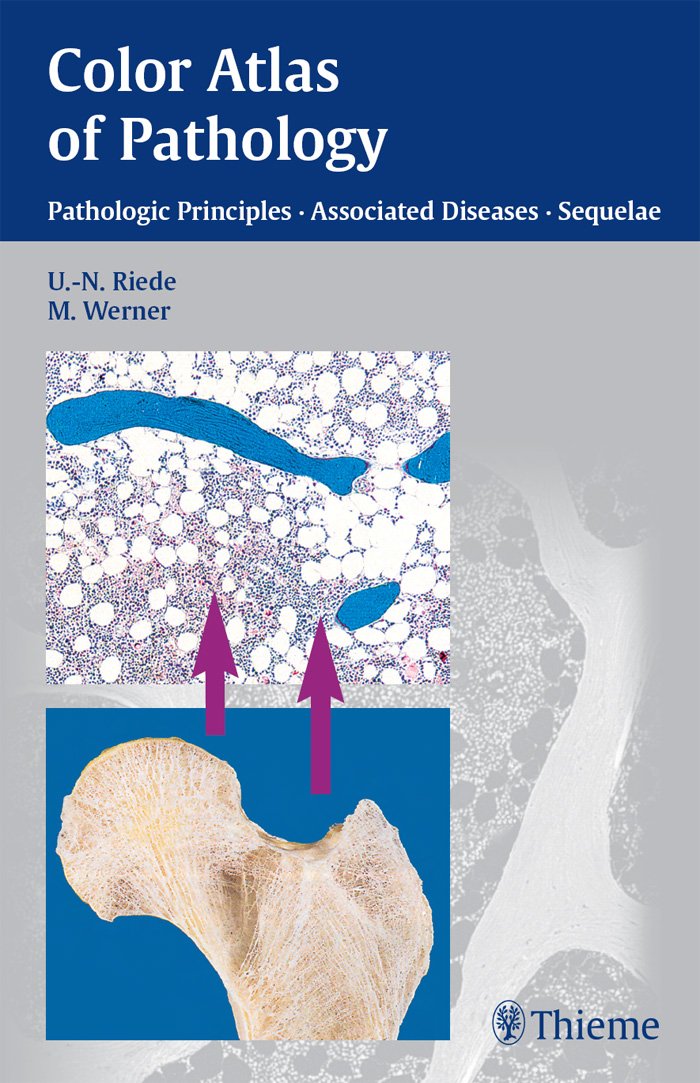 Color Atlas of Pathology Pathologic Principles-Associated Diseases-Sequela 1st Edition by Urs-Nikolaus Riede