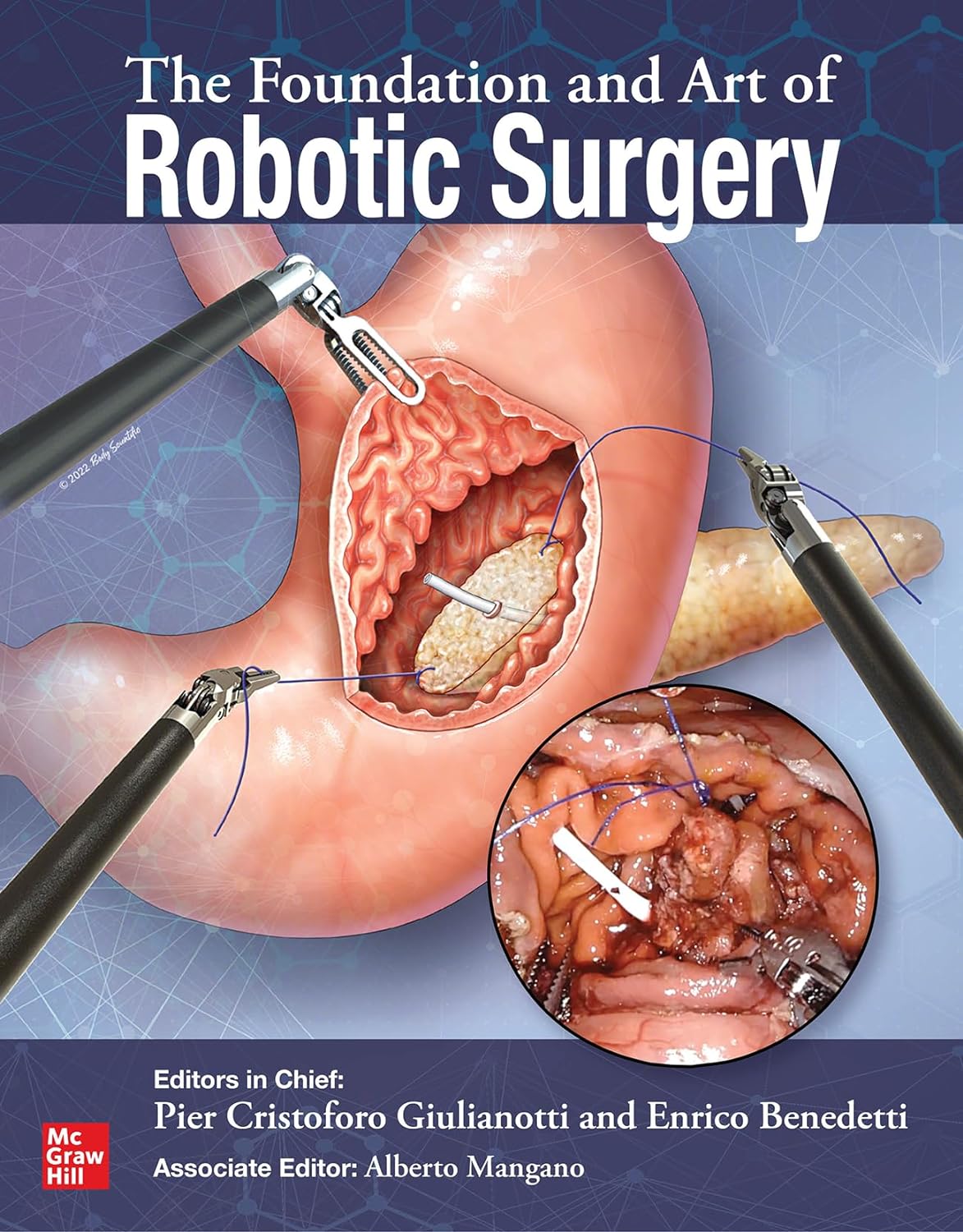 The Foundation and Art of Robotic Surgery  by Pier Cristoforo Giulianotti