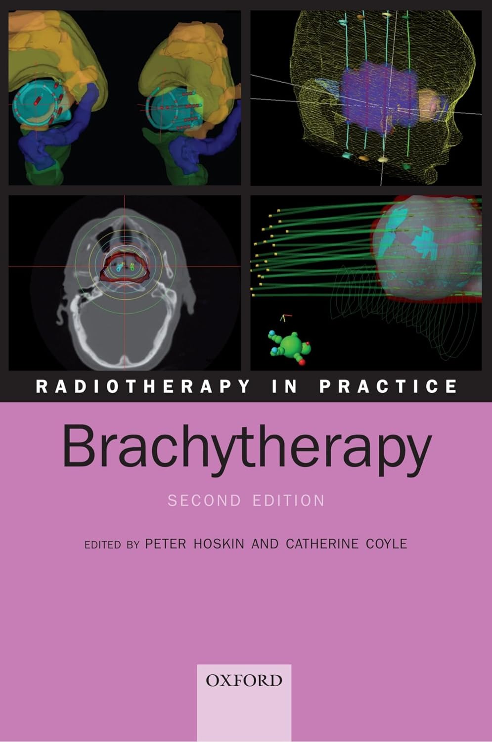 Radiotherapy in Practice - Brachytherapy, 2nd Edition  by Peter Hoskin