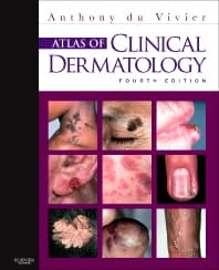 Atlas of Clinical Dermatology 4th Edition by du Vivier
