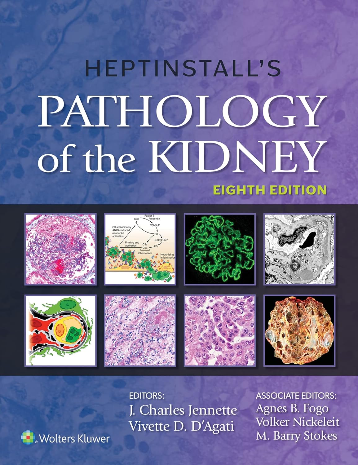 Heptinstall s Pathology of the Kidney Eighth Edition by  J. Charles Jennette 