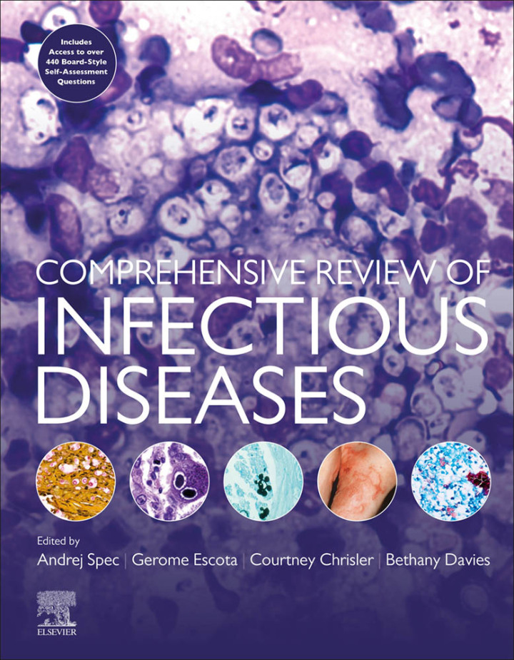 (eBook PDF) Comprehensive Review of Infectious Diseases 1st by  Andrej Spec